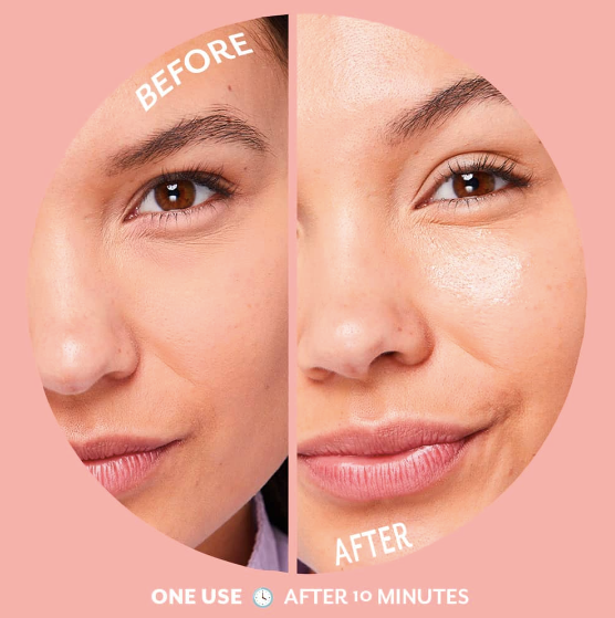 Bubbly hydrogel mask